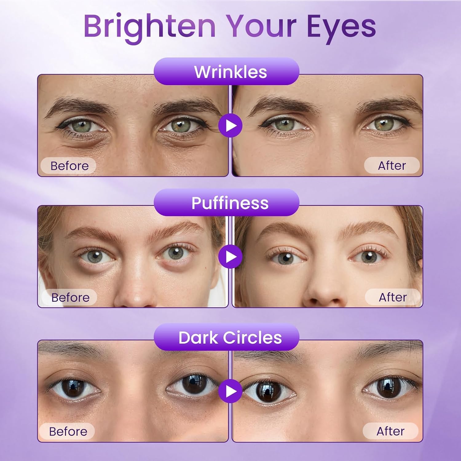 Doracome peptide complex for strengthened skin around the eyes.