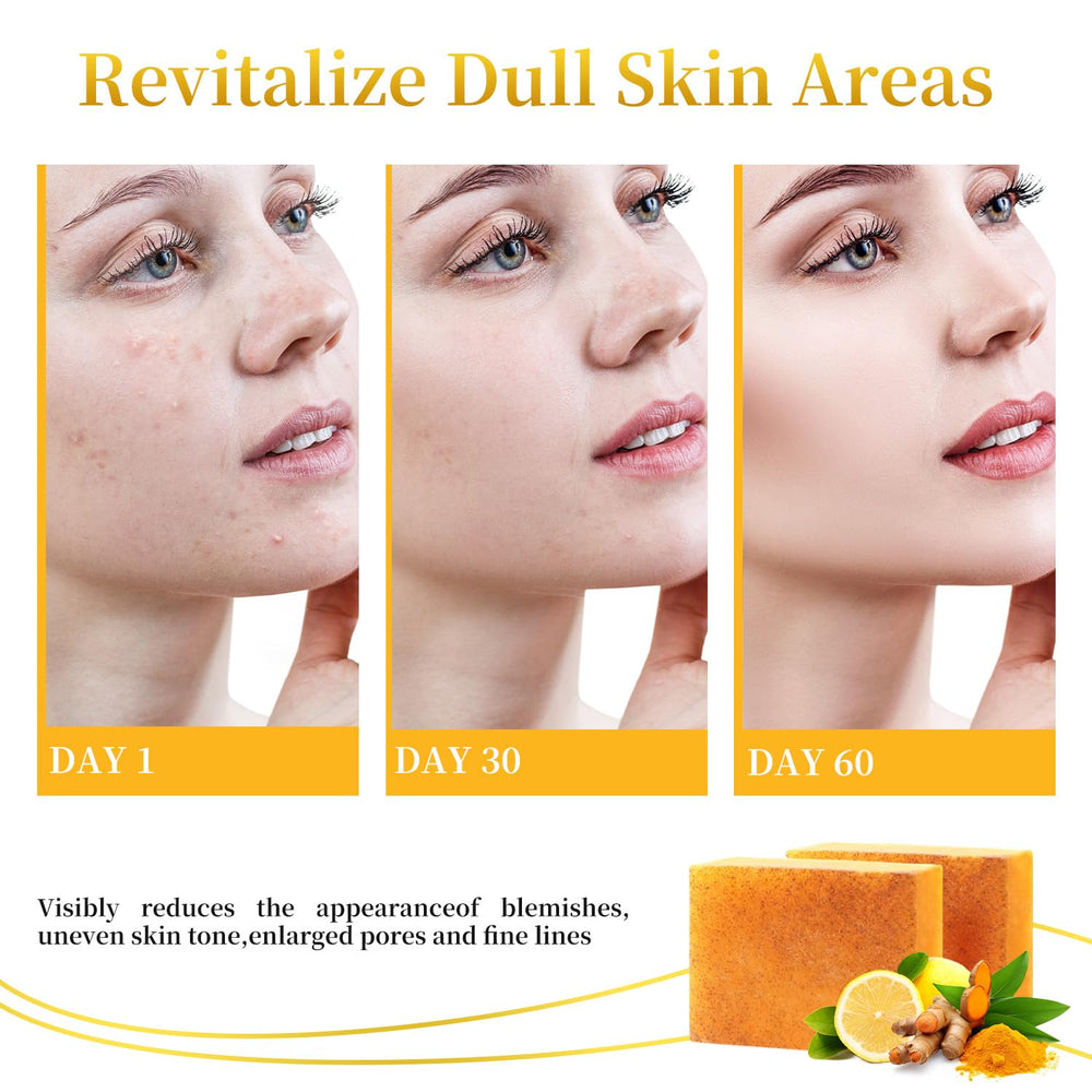 DOXOLATO Lemon Turmeric soap bar body view for full-body cleansing