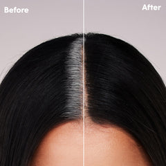 dpHUE two applications included enable multiple touch-ups between appointments.