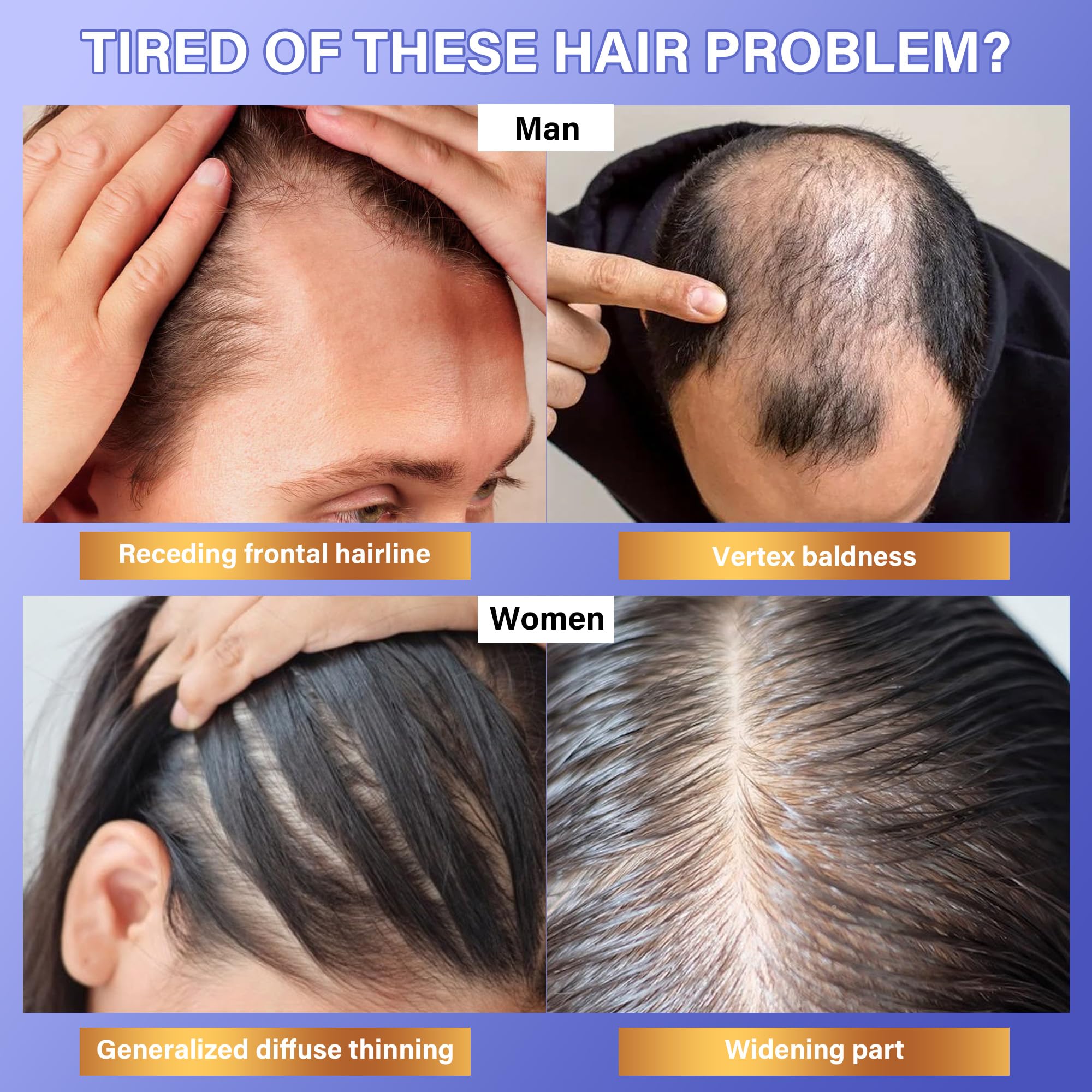 DR.Afanyr rosemary serum being applied to the scalp for targeted care