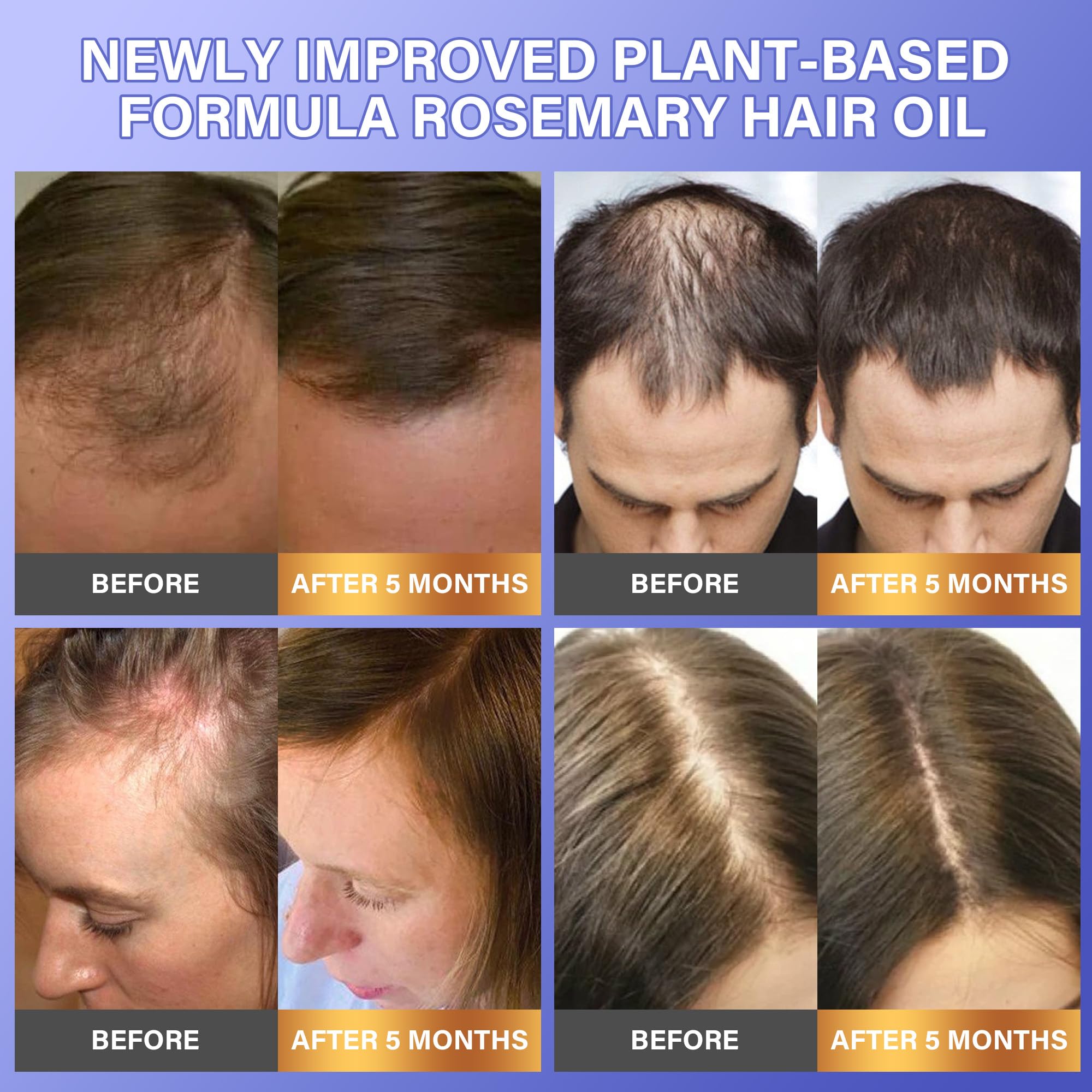 DR.Afanyr rosemary serum dropper dispensing on scalp
