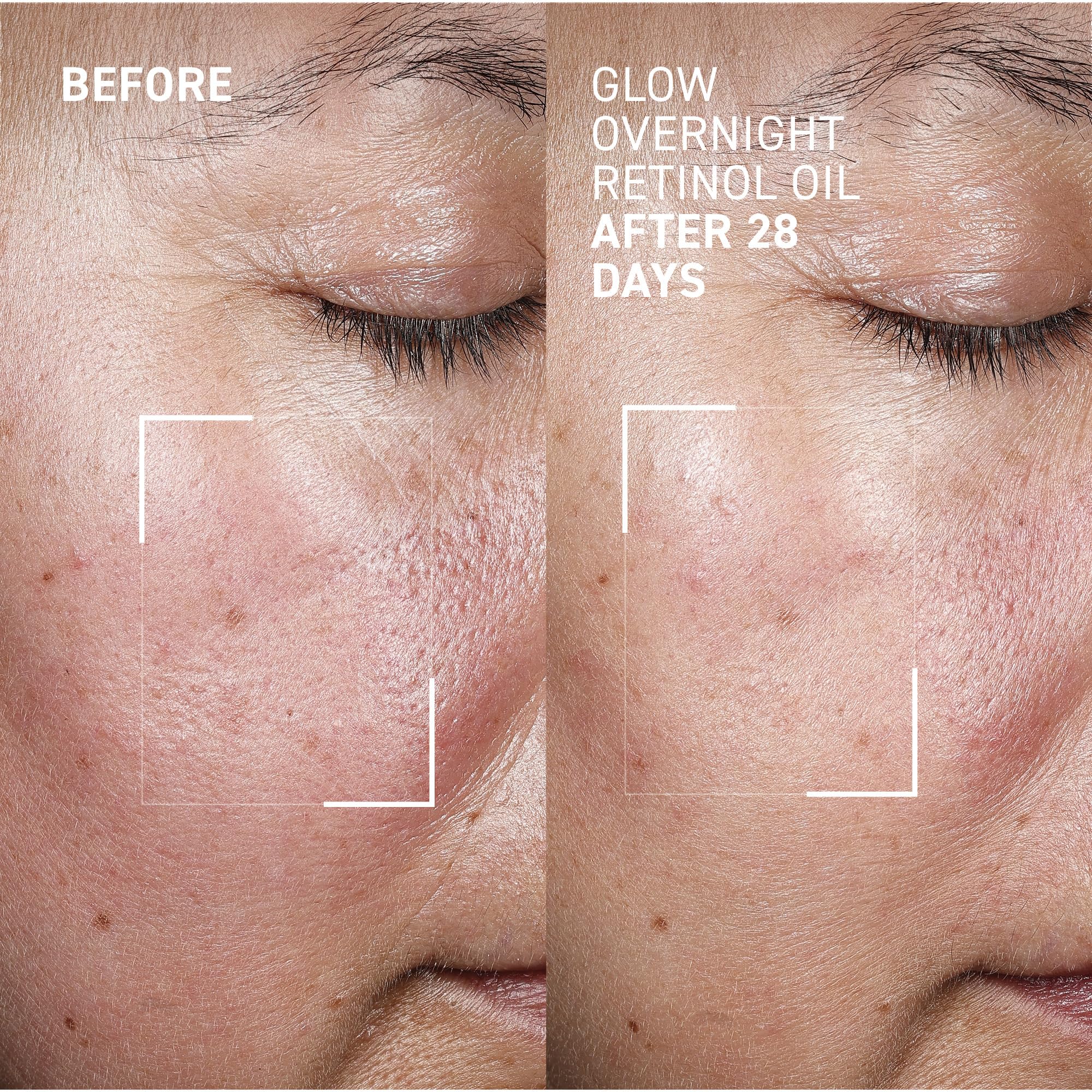 Dropper dispensing Dr. Brandt Glow Overnight Oil for nourishing night care.