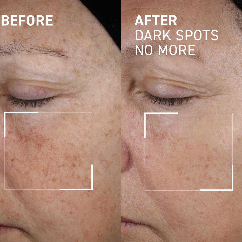 Dr. Brandt Bright This Way tip applying gel directly to pigmentation