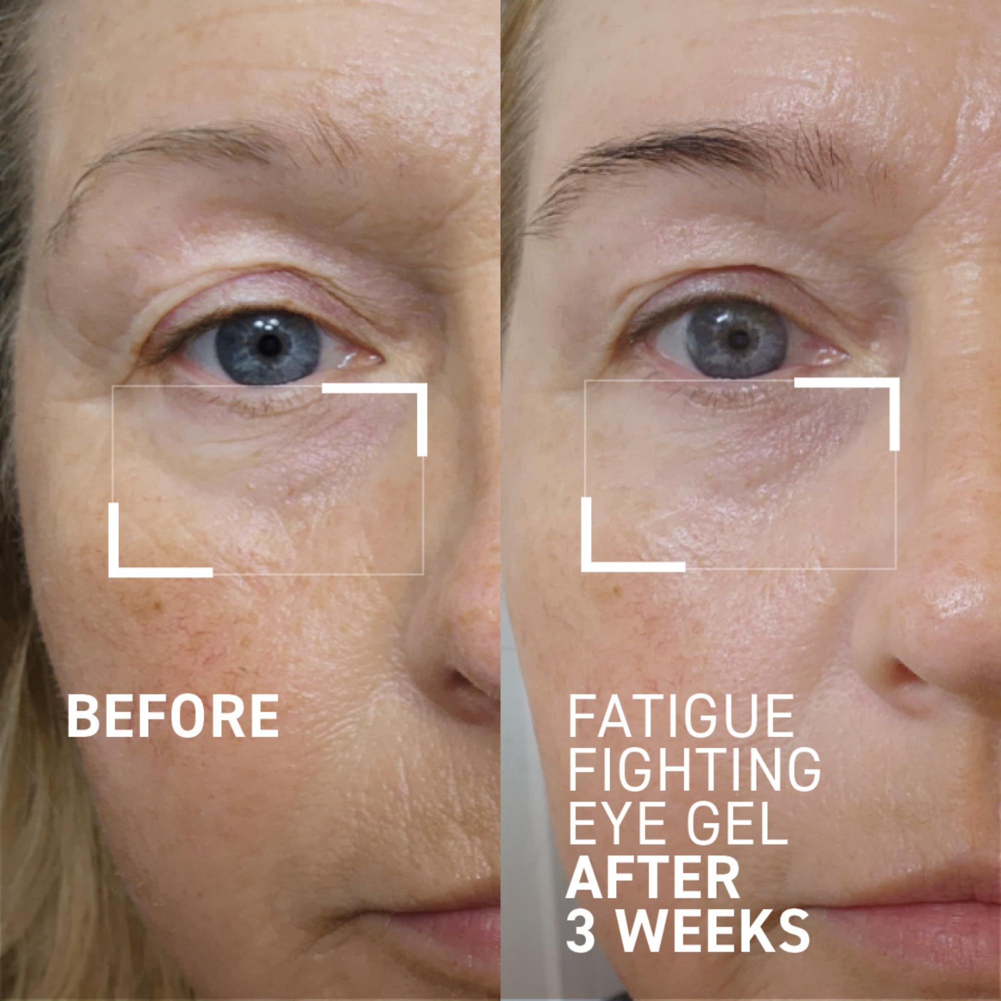 Dr. Brandt iD-STRESS eye gel delivers refreshing cooling sensation around the eyes.