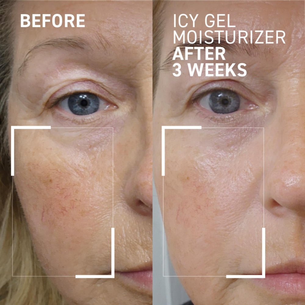 Close-up of the gel texture for a refreshing, non-greasy finish from Dr. Brandt iD-STRESS.