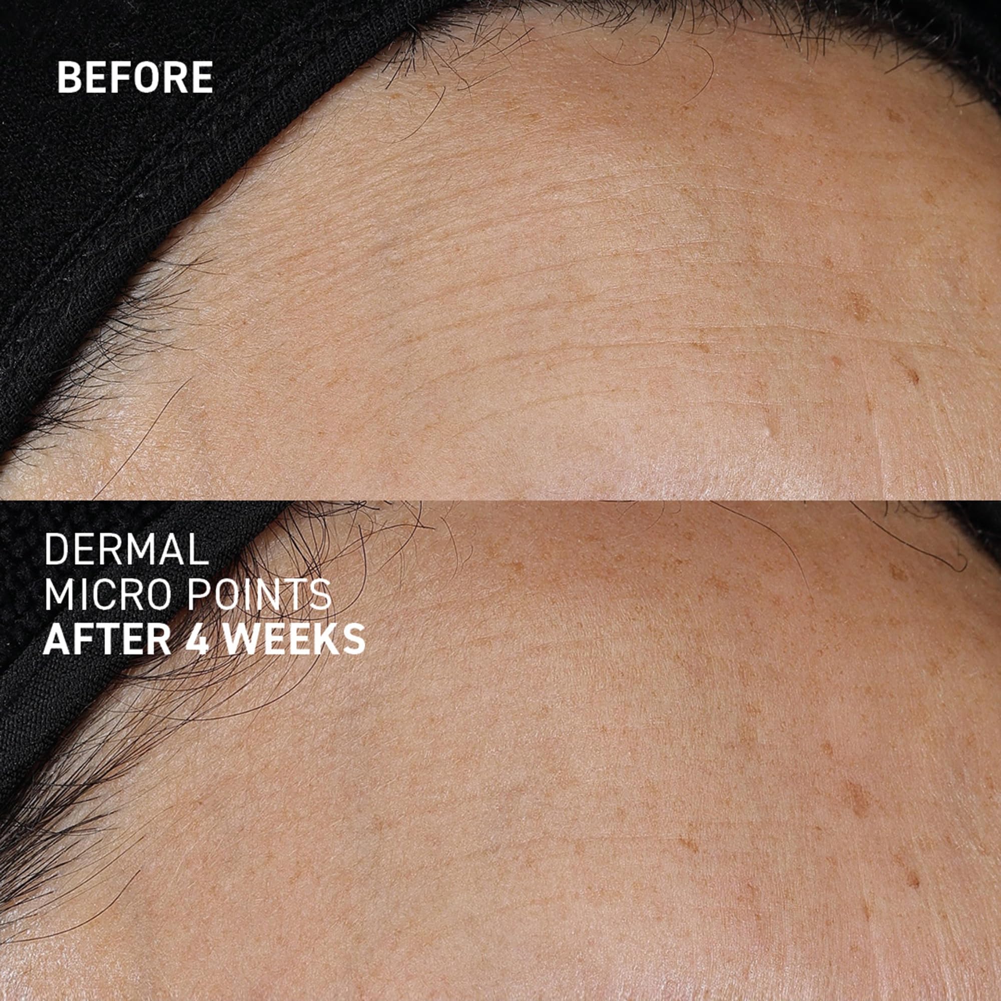 Dr. Brandt Needles No More smooths texture and refines fine lines over time.