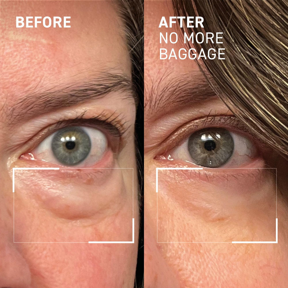 Dr. Brandt Needles No More Baggage fragrance-free formula works with makeup.