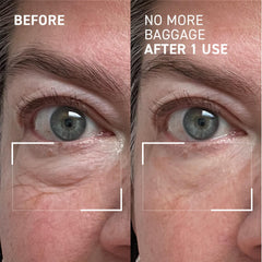 Dr. Brandt Needles No More Baggage gel transforms from cream to gel as it warms.