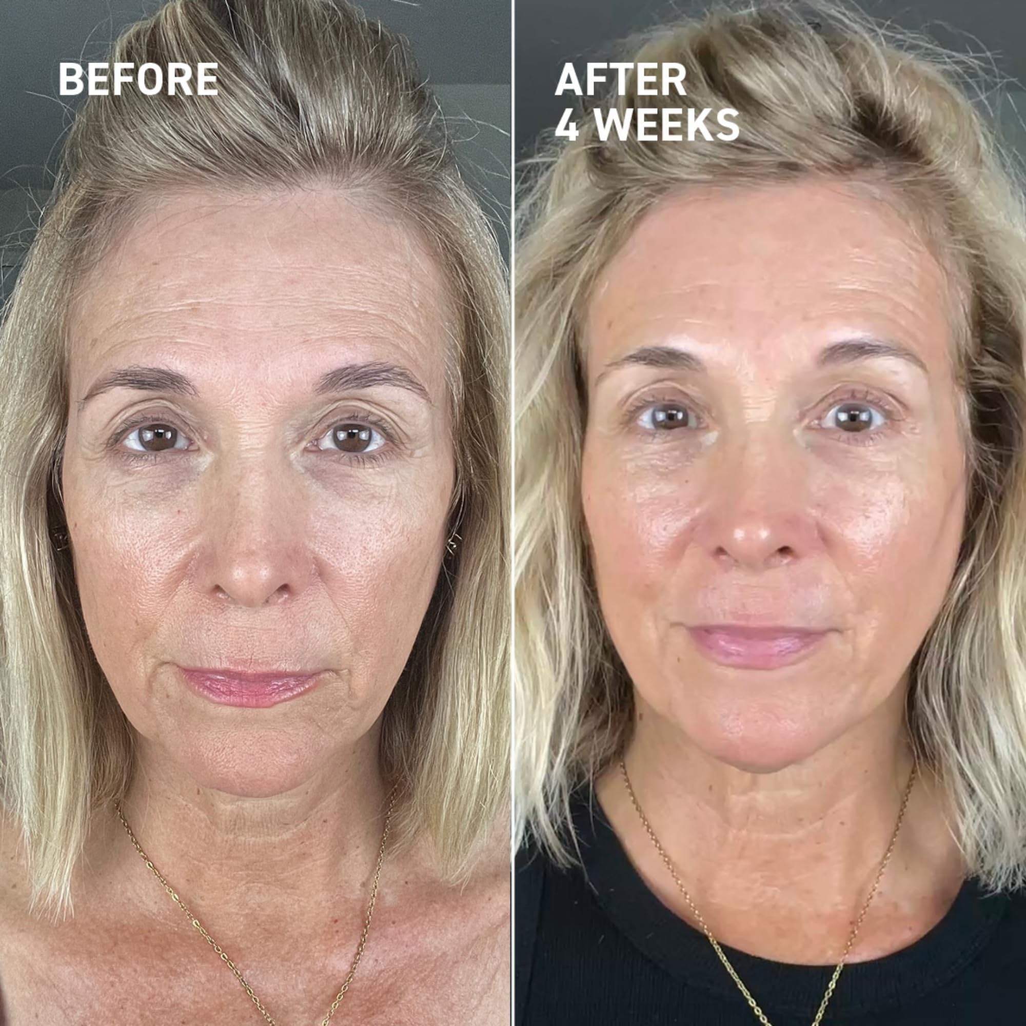 Dr. Brandt Needles No More gel texture shown on clean skin for smoothing.
