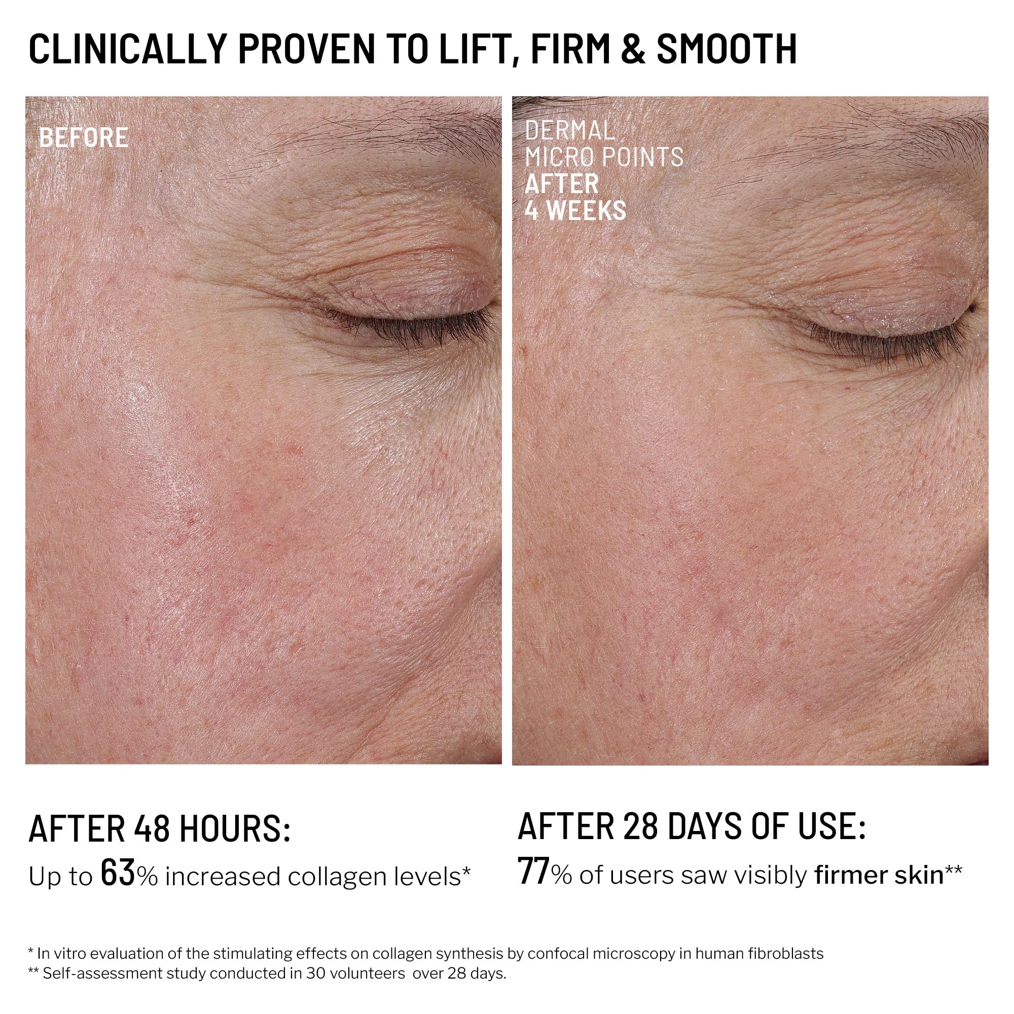 Dr. Brandt Needles No More pairs with Hyaluronic Face Cream for hydration.