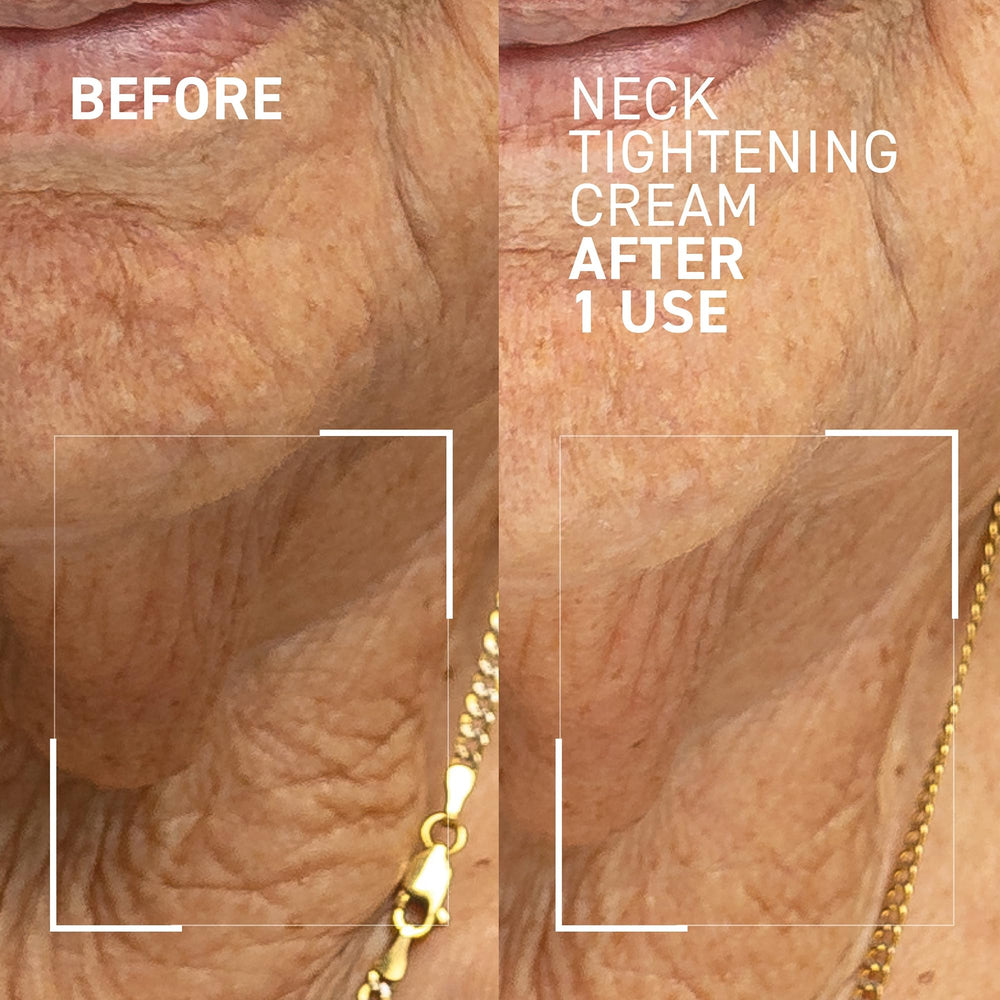 Dr. Brandt Needles No More cream application on the neck area for care