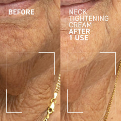 Dr. Brandt Needles No More cream application on the neck area for care