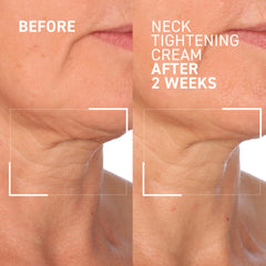 Cream texture close-up of Dr. Brandt Needles No More for a smooth finish