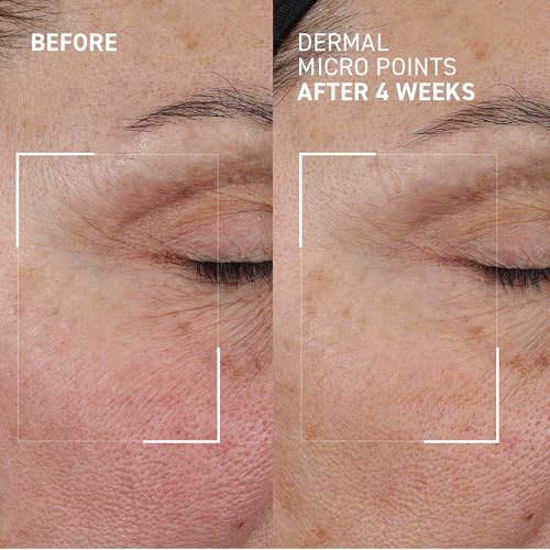 Dr. Brandt Needles No More doctor-designed skincare formula for targeted results.