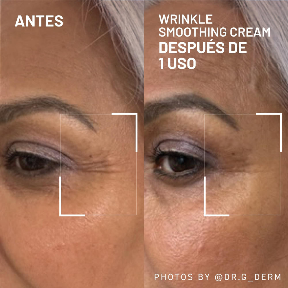 Dr. Brandt Needles No More smoothing cream applied to forehead lines demonstrates subtle smoothing and glow