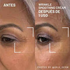 Dr. Brandt Needles No More smoothing cream applied to forehead lines demonstrates subtle smoothing and glow