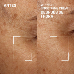 Dr. Brandt Needles No More smoothing cream targets frown lines for a refreshed expression