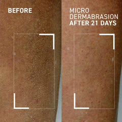 Dr. Brandt Skincare Microdermabrasion Hydrating Body Exfoliator on rough elbows and knees