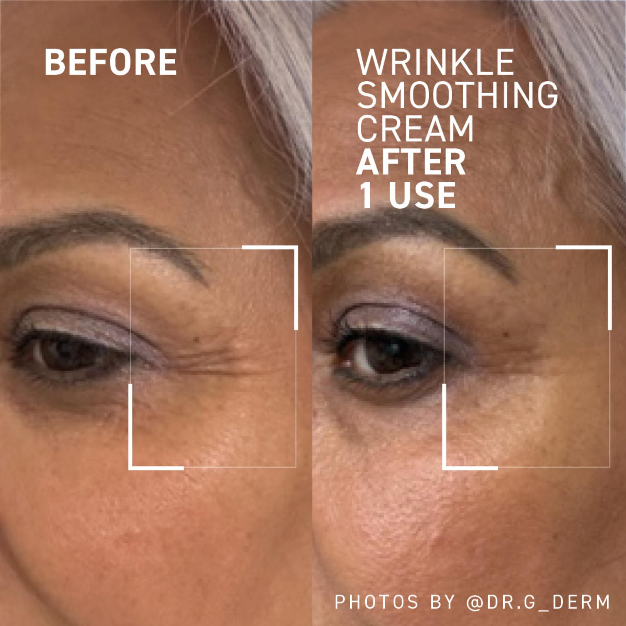 Dr. Brandt Needles No More Wrinkle Smoothing Cream softens crow's feet for a refreshed eye area.
