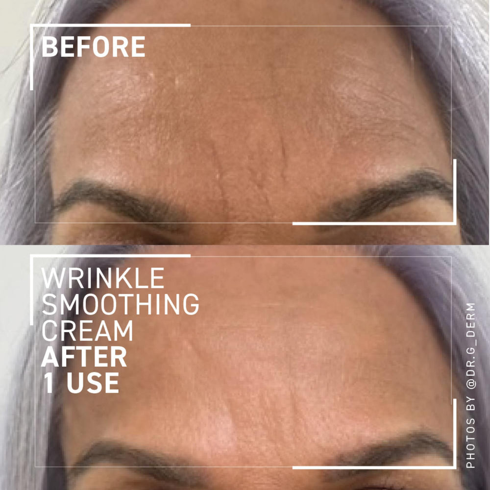 Dr. Brandt Needles No More Wrinkle Smoothing Cream smooths frown lines around eyes and brows.