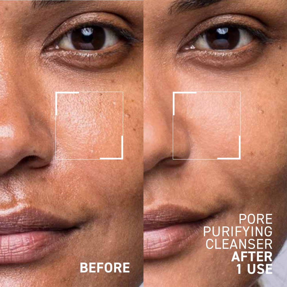 Close-up of Dr. Brandt Pores No More gel texture ready for a cleanse