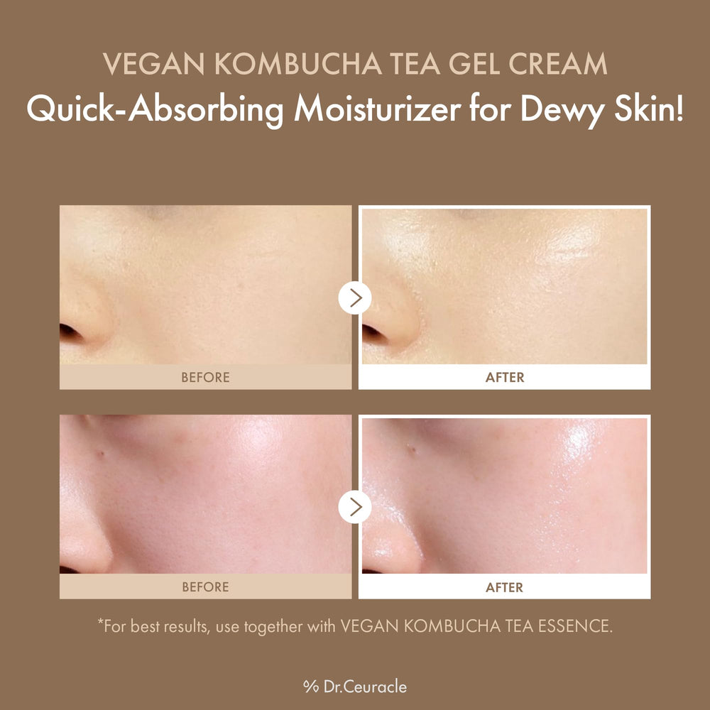Gel texture melts on skin for instant, non-sticky moisture from Dr. Ceuracle.