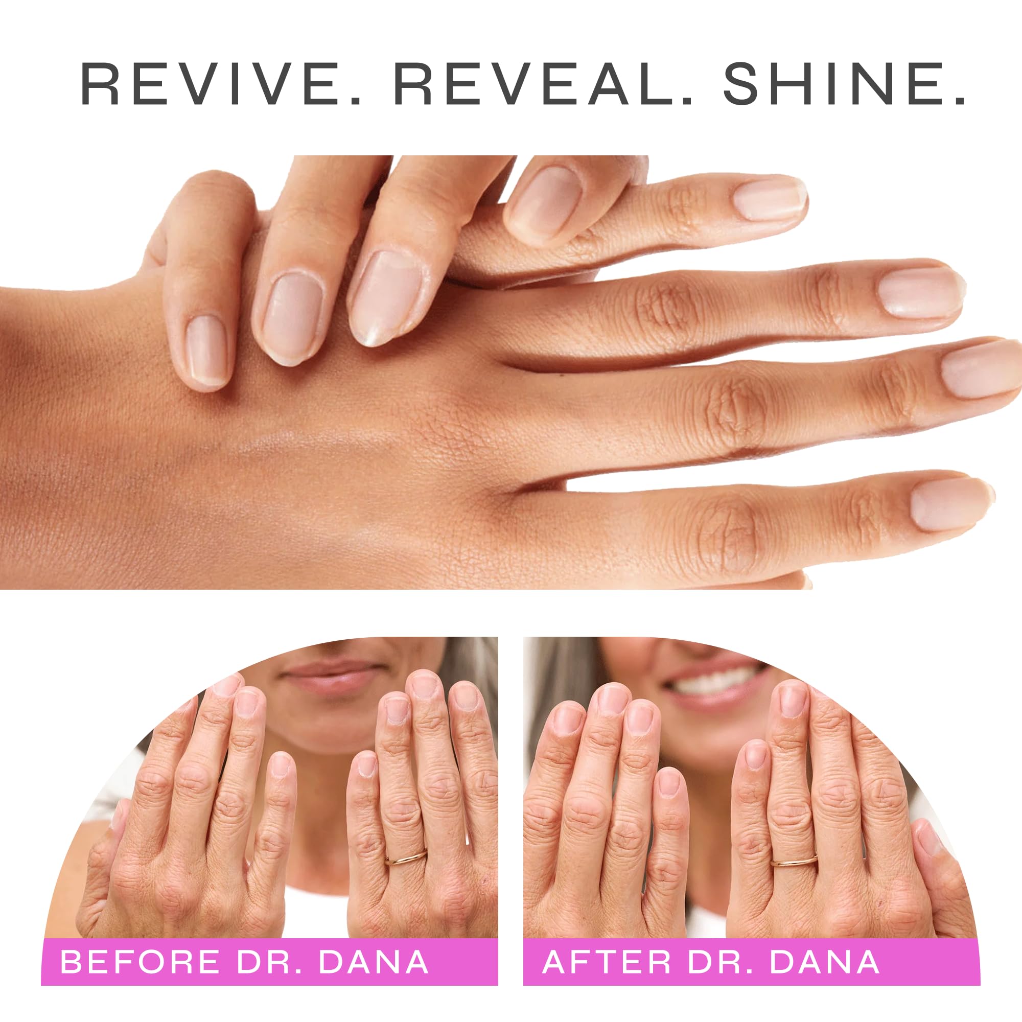 Dr. Dana hydrator in use to moisturize nails and support healthy edges.