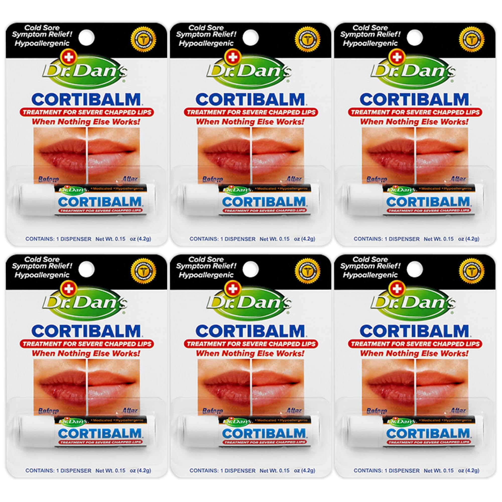 Dr. Dan's Cortibalm 6-pack lip balm jar showing healing for severely chapped lips