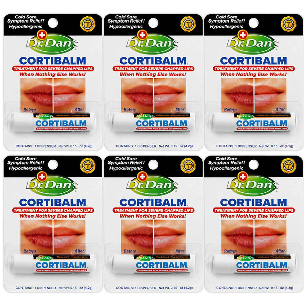 Dr. Dan's Cortibalm 6-pack lip balm jar showing healing for severely chapped lips