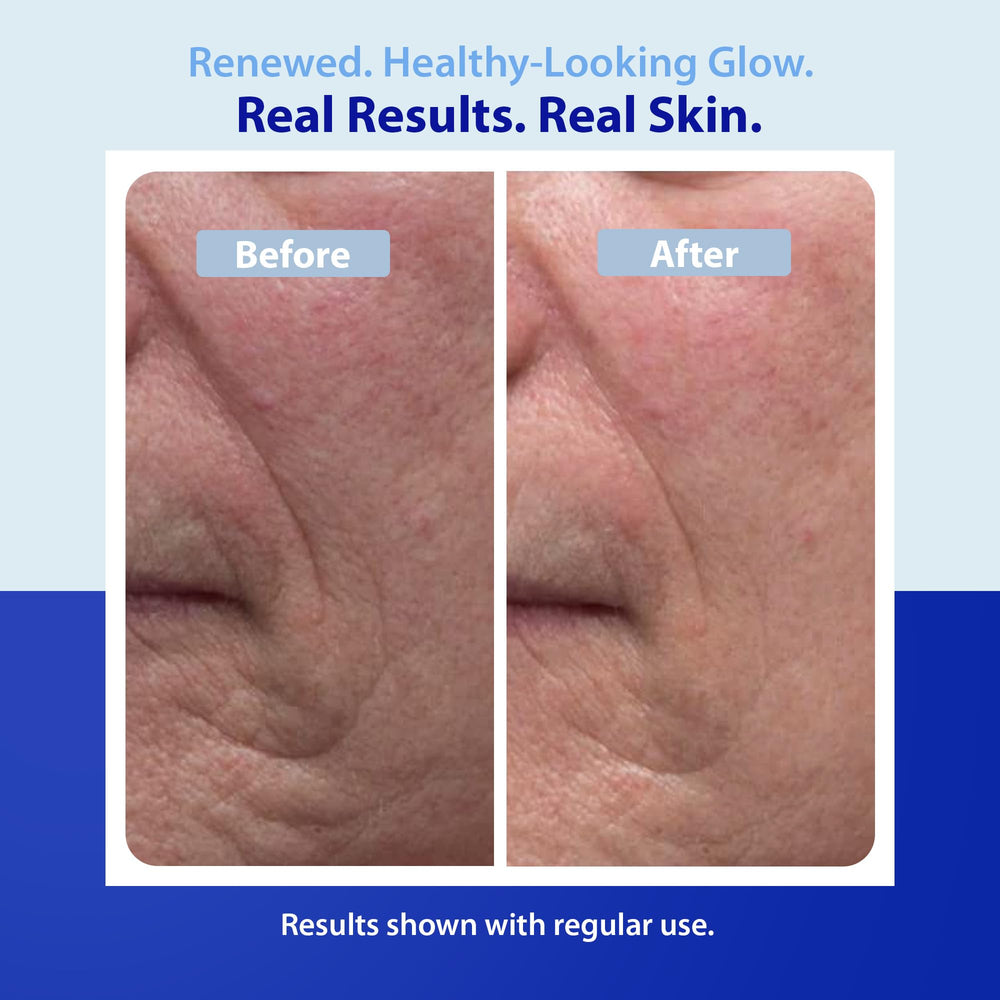 Mask peeling to reveal refreshed skin