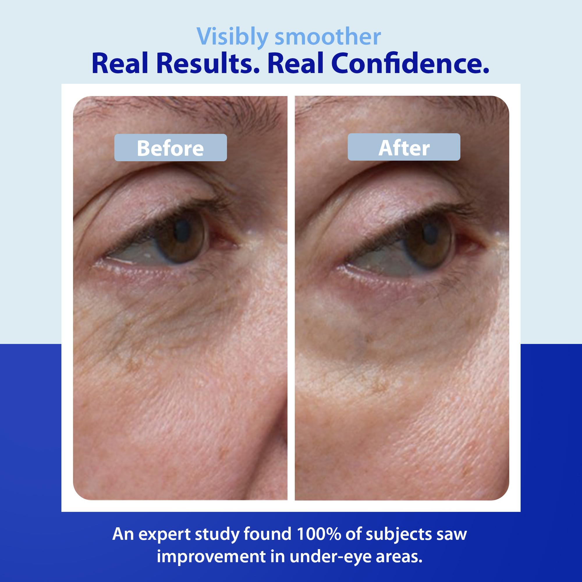 Peptides and ceramides reinforce the eye area’s resilience