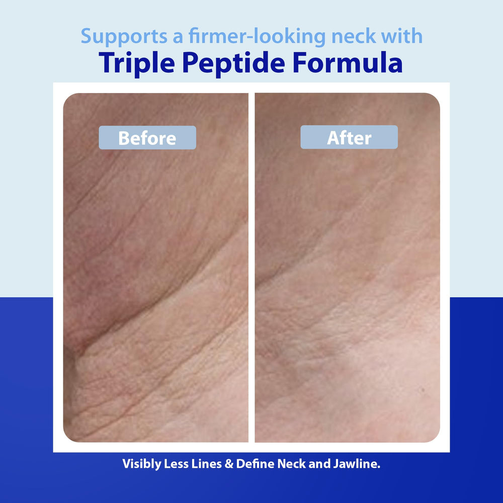 Dr. Denese neck smoother packaging showing clean paraben-free design