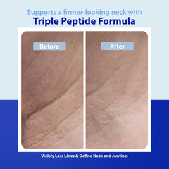 Dr. Denese neck smoother packaging showing clean paraben-free design
