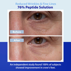 Dr. Denese Wrinkle RX concentrate texture close-up with a lightweight finish.