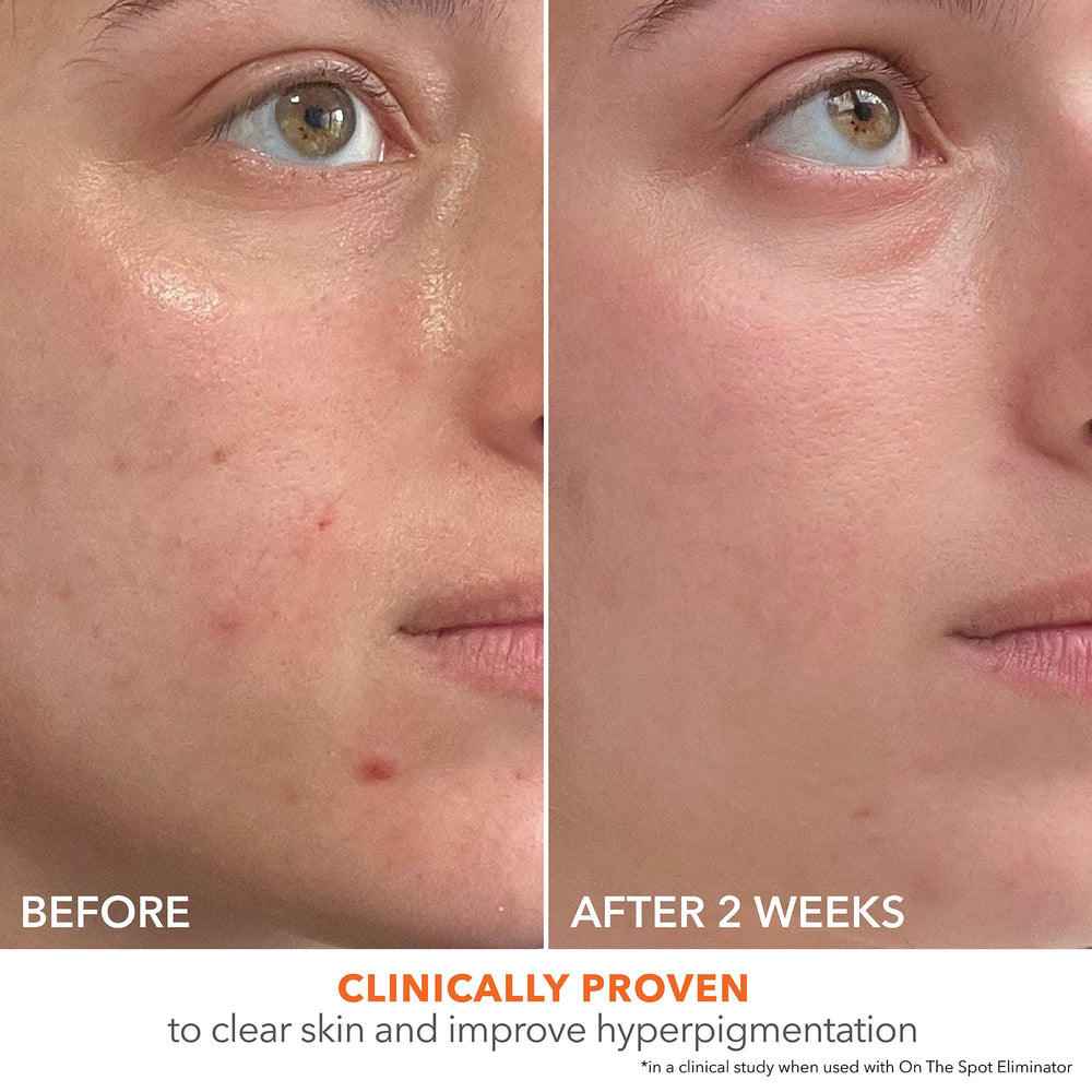 Dr Dennis Gross Alpha Beta 2% BHA+ application on face demonstrates easy nightly routine.