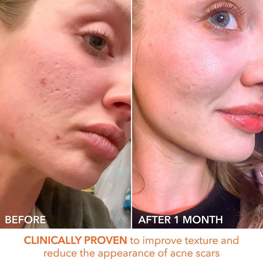 Box and bottle of Dr Dennis Gross Alpha Beta Extra Strength Daily Peel.
