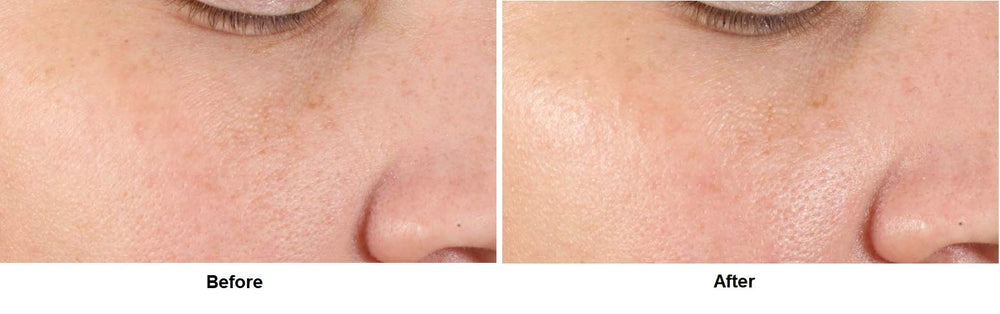 Dr Dennis Gross Alpha Beta farnesol ingredient highlights pore-supporting components
