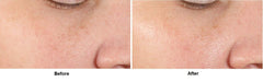 Dr Dennis Gross Alpha Beta farnesol ingredient highlights pore-supporting components