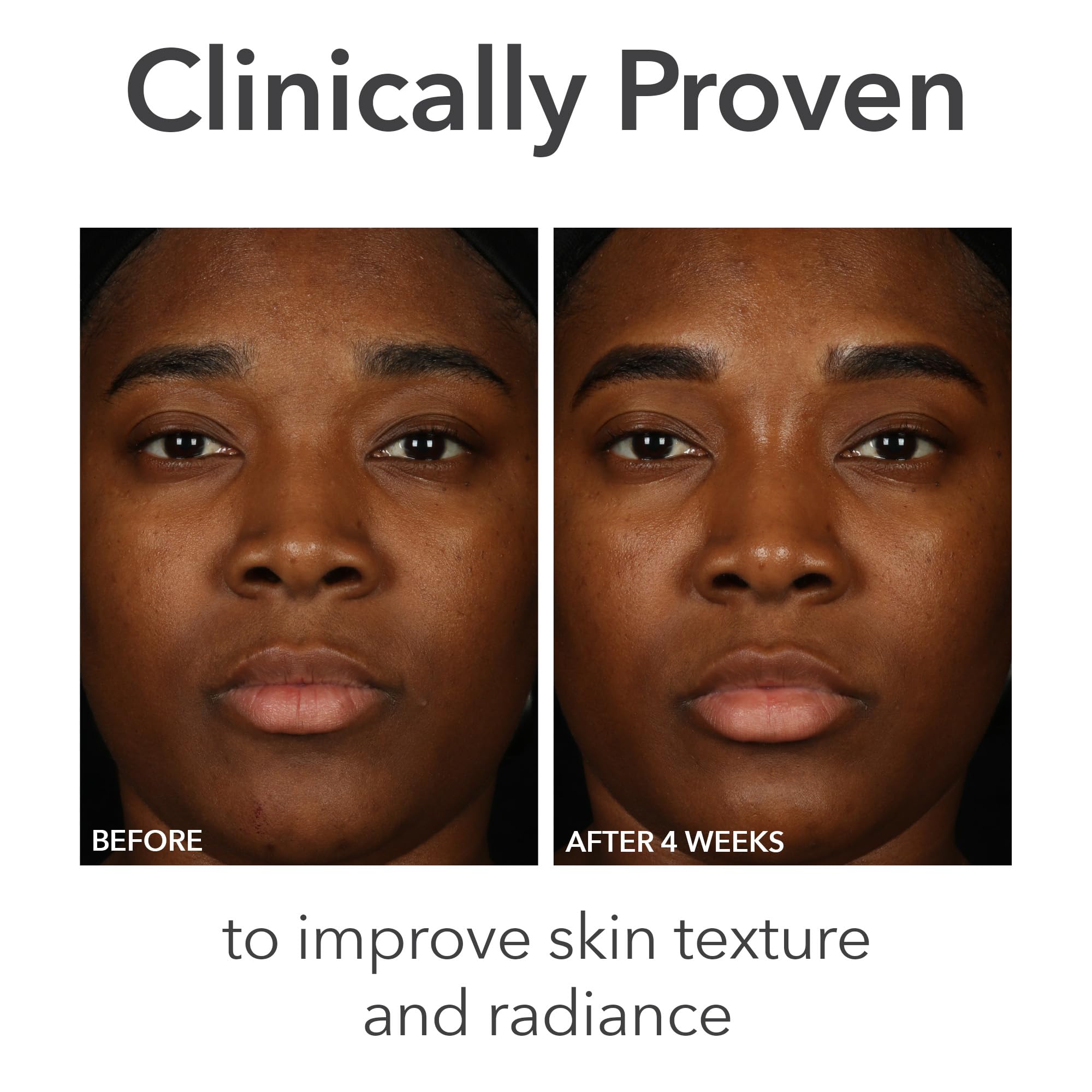 Dr Dennis Gross Alpha Beta Balance applied on face demonstrates soothing hydration.