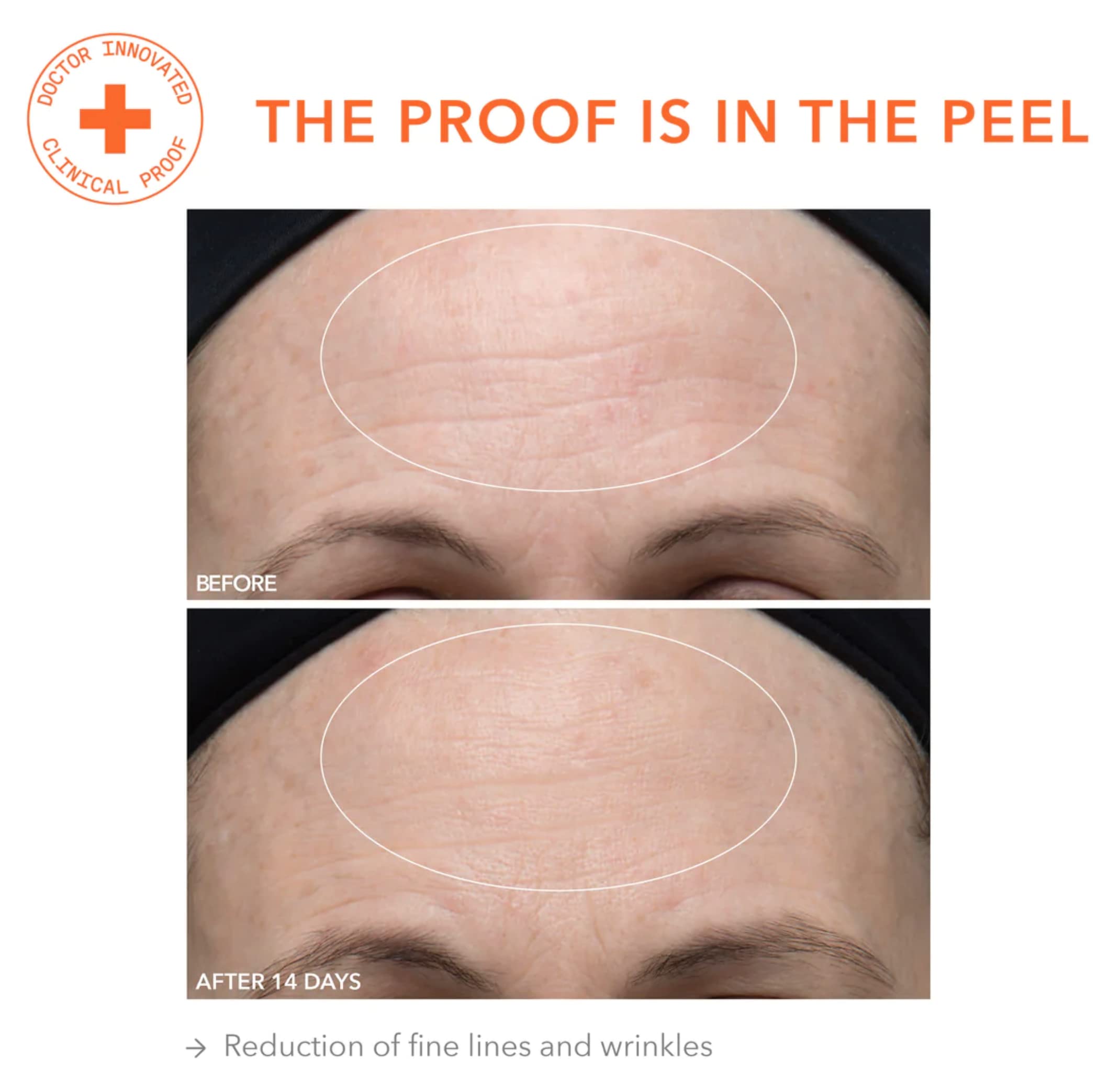 Dr Dennis Gross Alpha Beta Ultra Gentle Daily Peel texture demonstration showing instant smoothness.