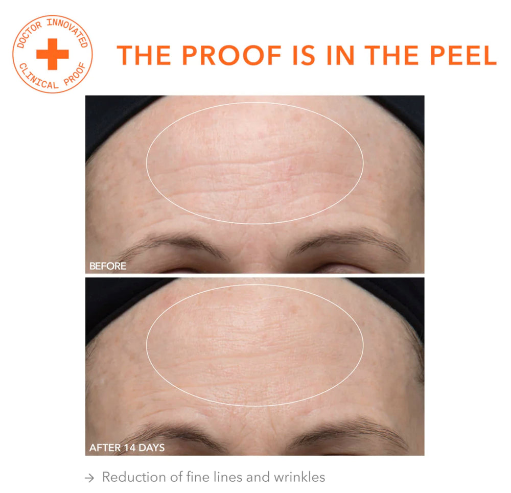 Dr Dennis Gross Alpha Beta Ultra Gentle Daily Peel texture demonstration showing instant smoothness.