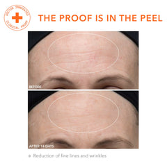 Dr Dennis Gross Alpha Beta Ultra Gentle Daily Peel texture demonstration showing instant smoothness.