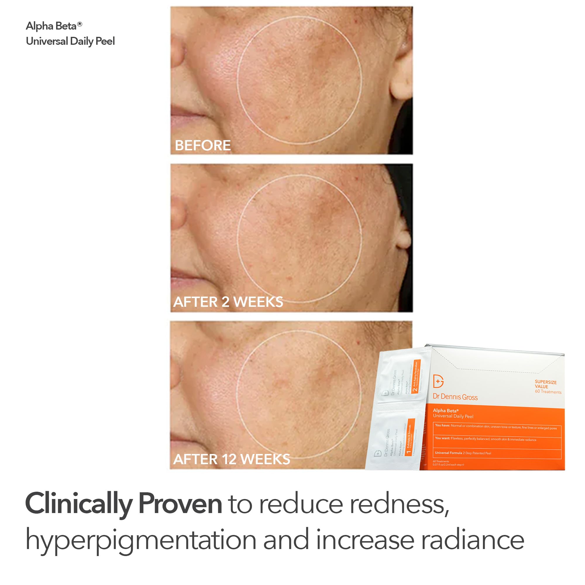 Dr Dennis Gross Alpha Beta Universal Daily Peels for everyday radiance.