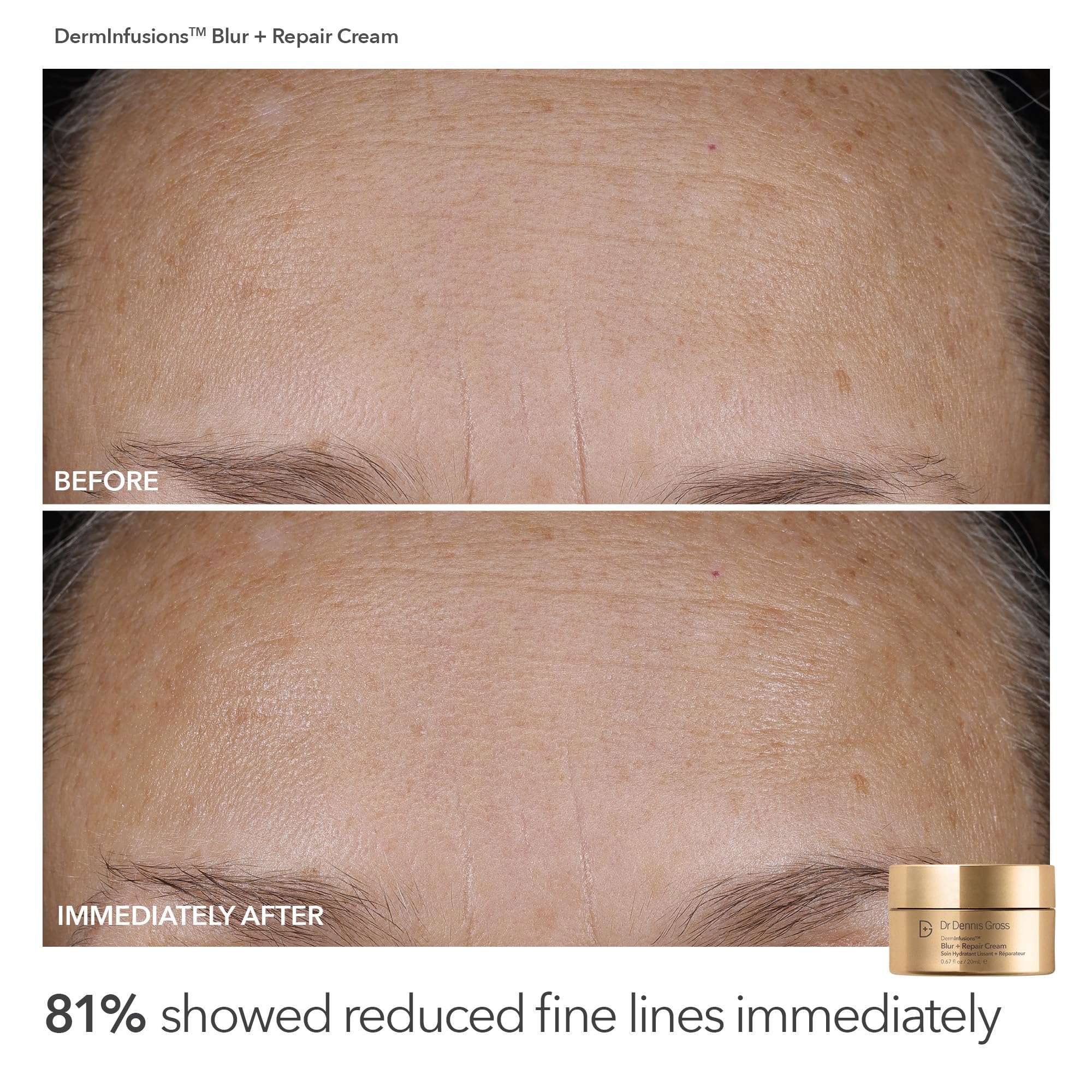 Five Alpha Beta Universal Daily Peels packets arranged for quick at-home exfoliation.