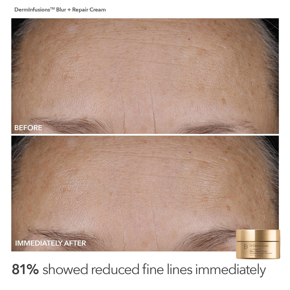 Five Alpha Beta Universal Daily Peels packets arranged for quick at-home exfoliation.