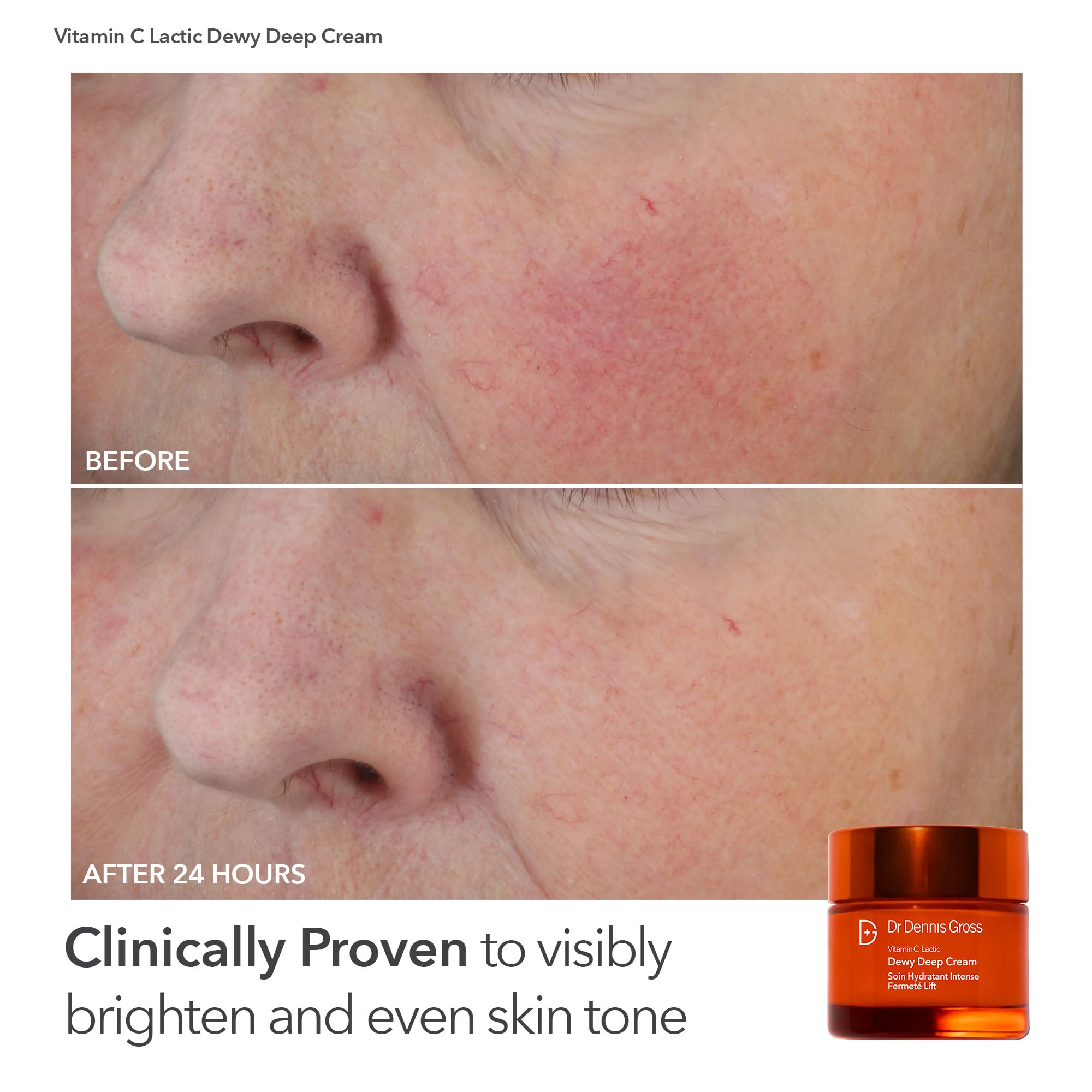 Dr Dennis Gross at-home spa experience with LED therapy.