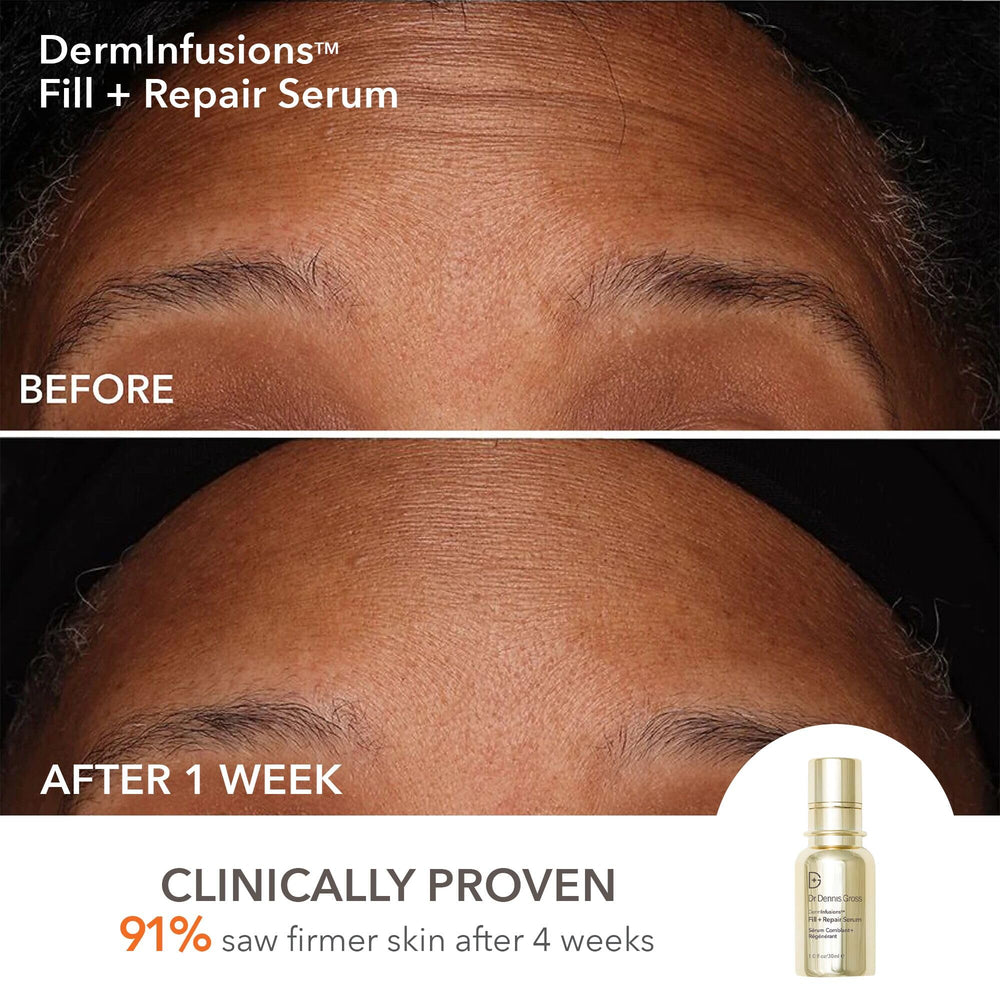 Fill + Repair Serum bottle during application for deeper hydration.