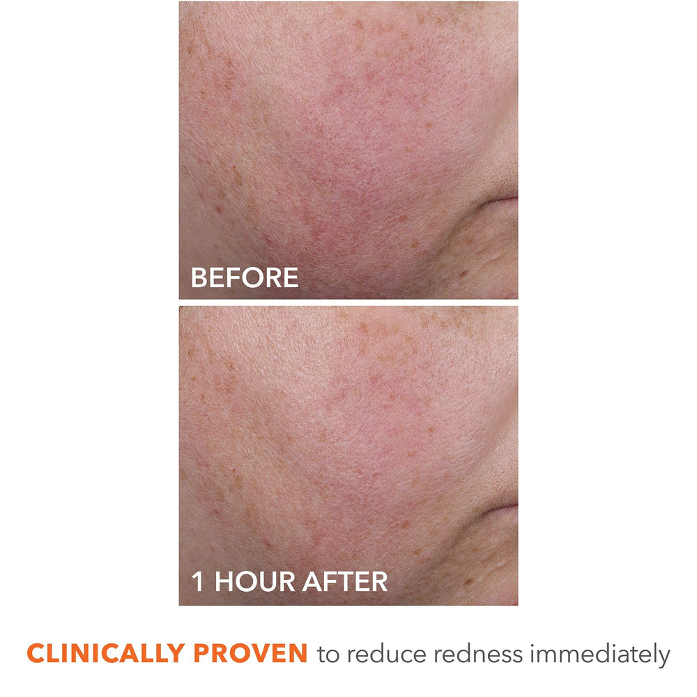 DermInfusions ingredients highlight peptides and hyaluronic acid for hydrated, resilient skin