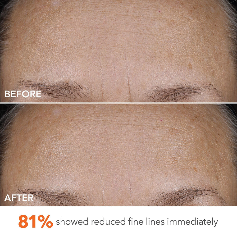 Dr Dennis Gross DermInfusions visual plumpness concept image suggests fuller texture