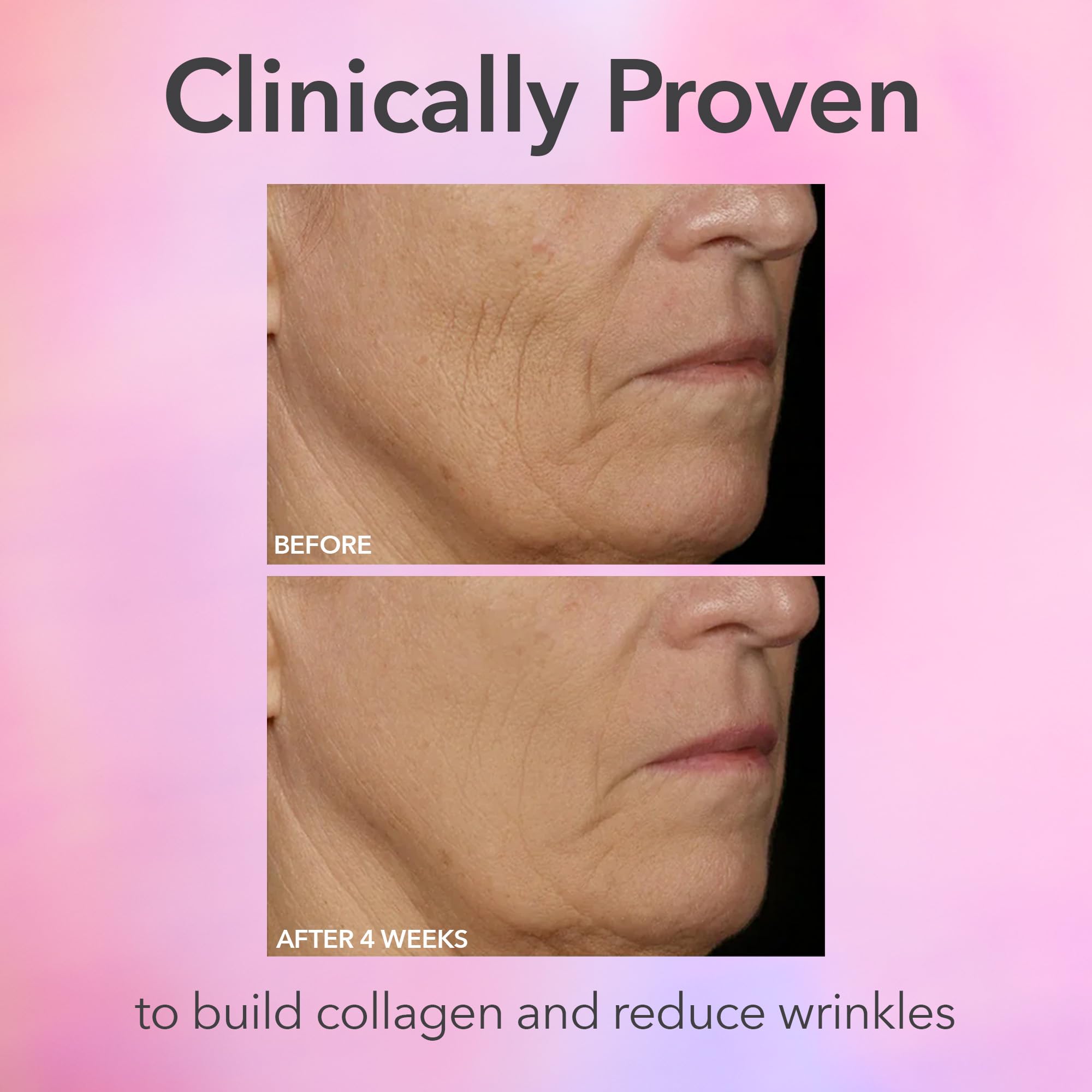 Dr Dennis Gross FaceWare Pro worn on the face showing hands‑free treatment for refreshed look